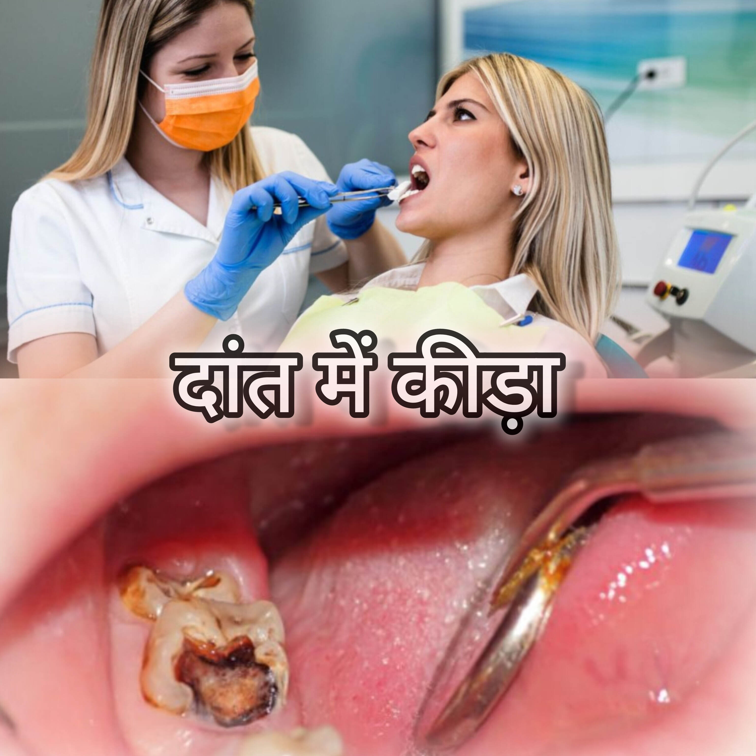 दांत में कीड़ा लग जाए तो क्या करें?
